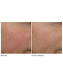 Display Product Shot: Overnight Wrinkle Serum Treatment, Image 5 of 7