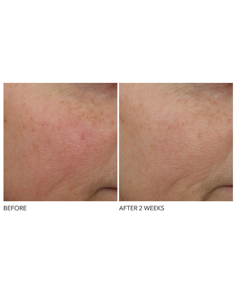 Overnight Wrinkle Serum Treatment, Image 5 of 7
