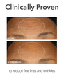 Display Product Shot: Extra Strength Daily Peel, Image 4 of 11
