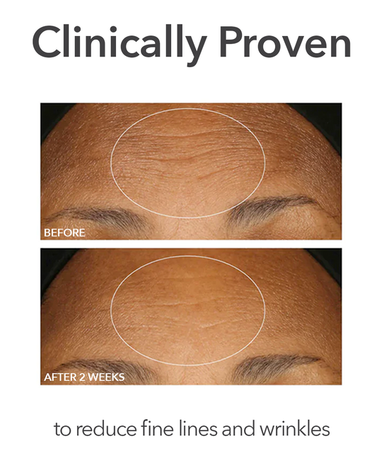 Amazon.com: Dr. Dennis Gross Skincare Alpha Beta Extra