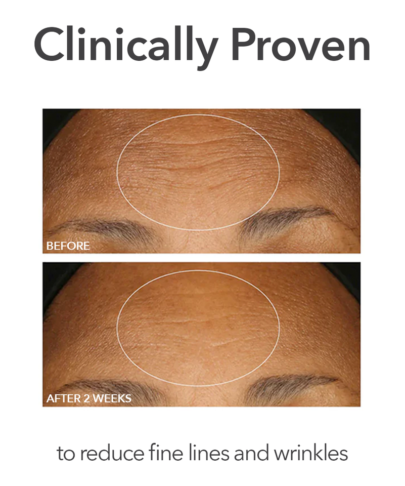 Extra Strength Daily Peel, Image 4 of 11