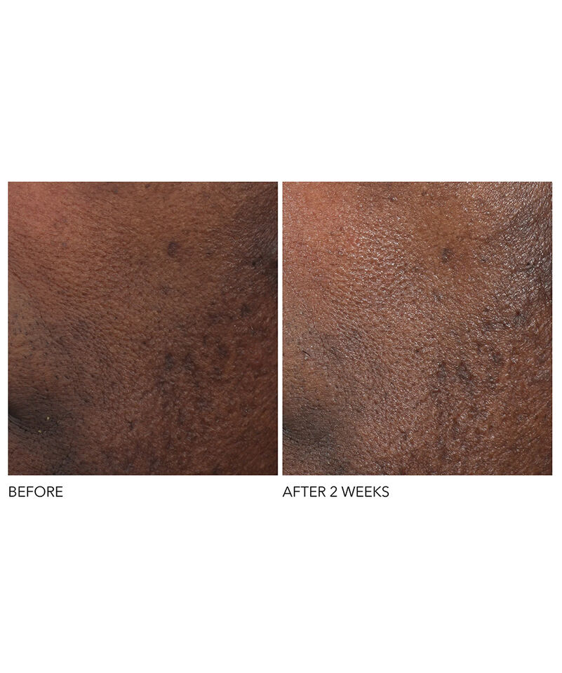 Overnight Wrinkle Serum Treatment, Image 6 of 7