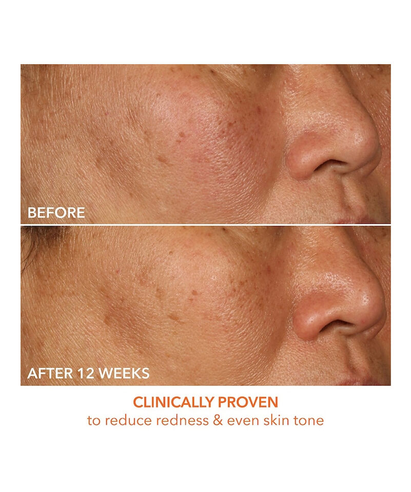 15% Vitamin C Firm & Bright Serum, Image 5 of 7