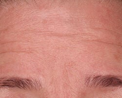 Photo before using Fill + Repair Serum with Hyaluronic Acid