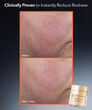 Display Product Shot: Blur + Repair Moisturizer Cream with Hyaluronic Acid, Image 8 of 12