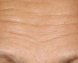 Photo before using 15% Vitamin C Firm & Bright Serum