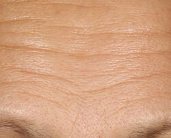 Photo before using 15% Vitamin C Firm & Bright Serum