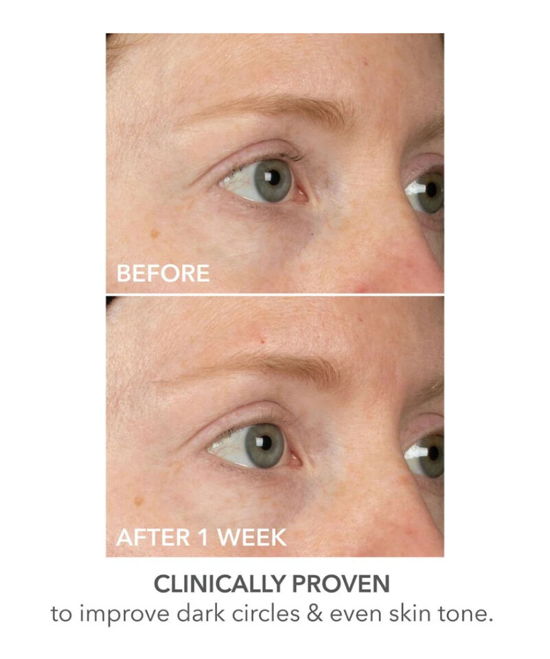 Lift + Repair Eye Mask, Image 4 of 6