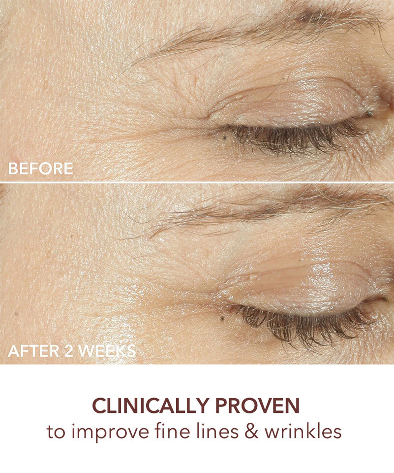 Triple Correction Eye Serum, Image 5 of 9