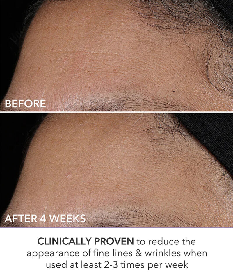 Perfectly Dosed Treatment (Extra Strength 0.5%), Image 7 of 11