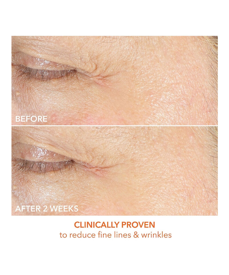 Firm & Bright Eye Treatment, Image 6 of 8