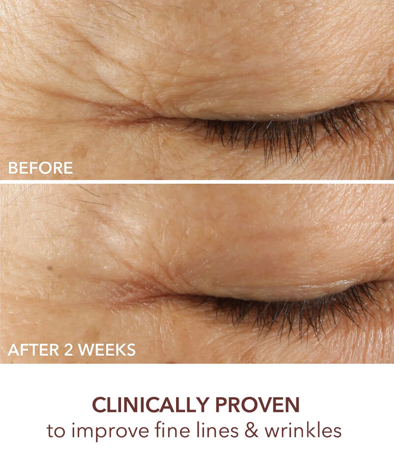 Triple Correction Eye Serum, Image 6 of 9
