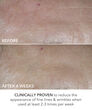 Display Product Shot: Perfectly Dosed Treatments (Universal 0.2%), Image 5 of 11