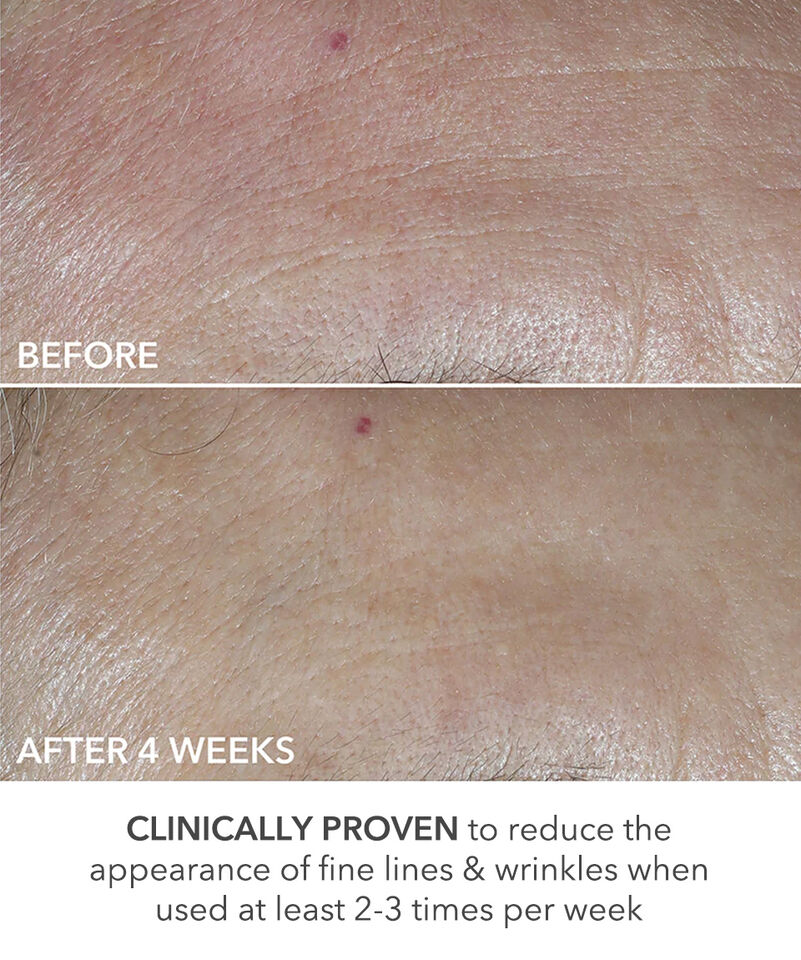 Perfectly Dosed Treatments (Universal 0.2%), Image 5 of 11