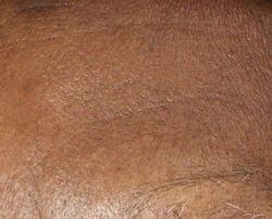 Photo after using Wrinkle Moisturizing Cream