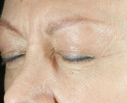 Photo before using Triple Correction Eye Serum