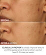 Display Product Shot: Perfectly Dosed Treatment (Extra Strength 0.5%), Image 5 of 11
