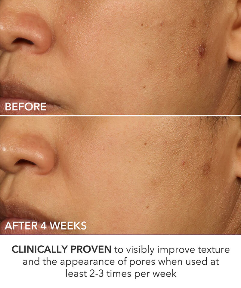 Perfectly Dosed Treatment (Extra Strength 0.5%), Image 5 of 11