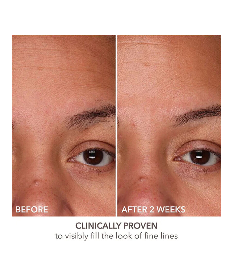 美容液 Dr Dennis Gross DermInfusions Fill DermInfusions™ Fill + Repair Serum | Dr Dennis Gross