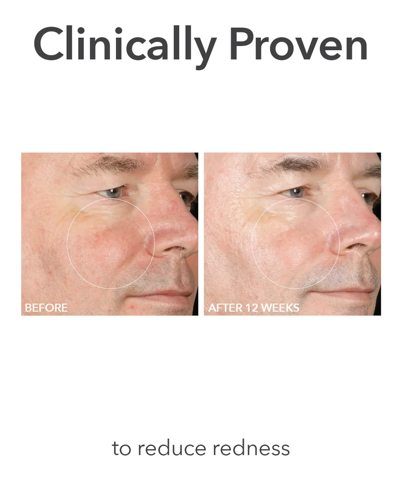 Extra Strength Daily Peel, Image 6 of 11