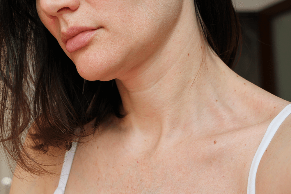 What is Tech Neck? Plus, Neck Skincare Tips
