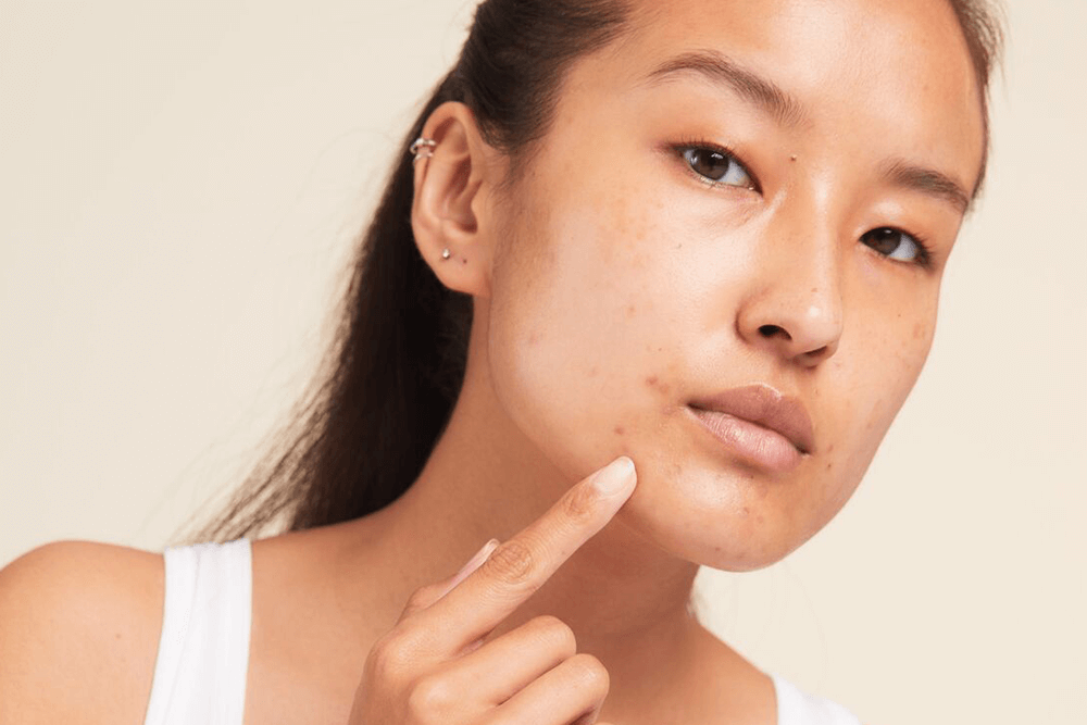 The Ultimate Routine to Improve Your Skin’s Tone and Texture