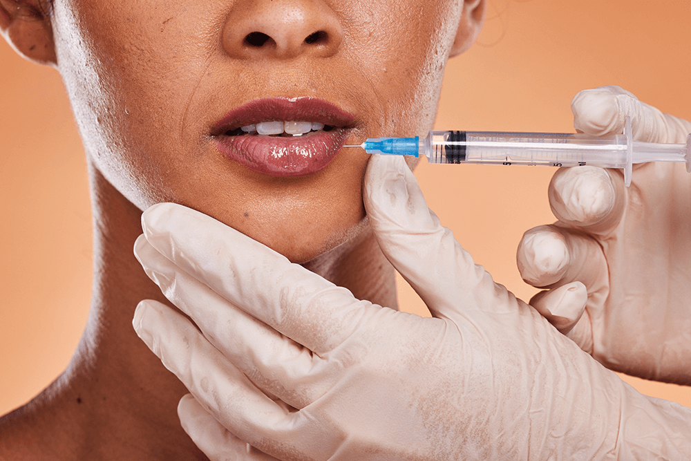 Lip Filler 101: What to Know About Lip Filler