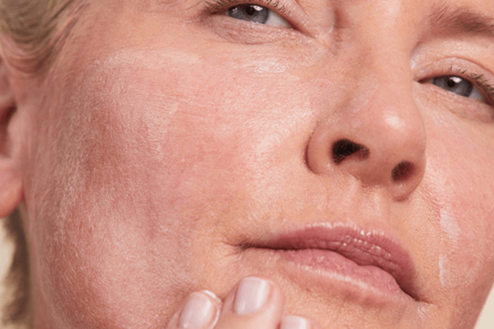Ask the Doctor: A Guide to Menopausal Skincare
