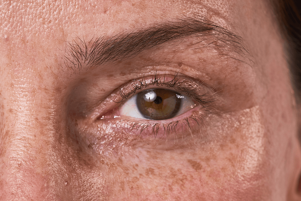 What Are Free Radicals and How Do They Affect Your Skin?