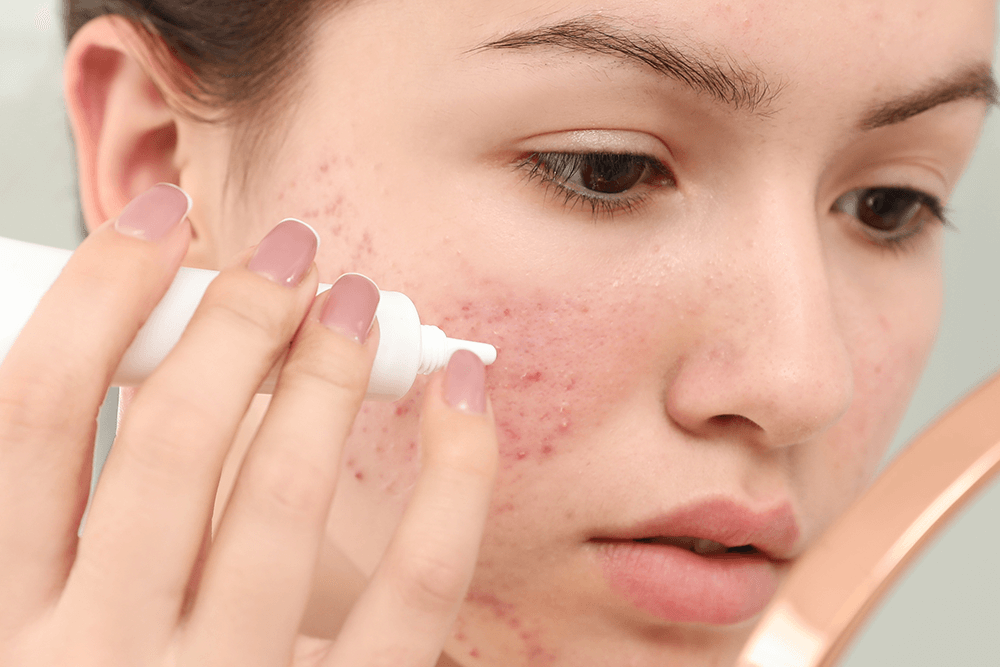 The Truth About Tretinoin—6 Things You Need to Know