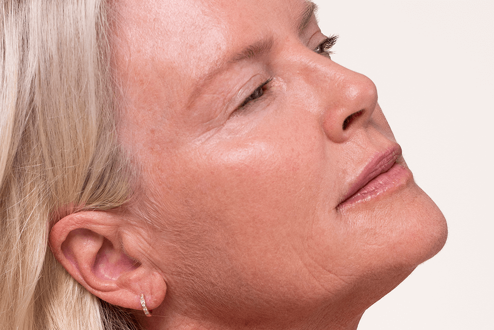 Perimenopause and Menopause Skincare Tips
