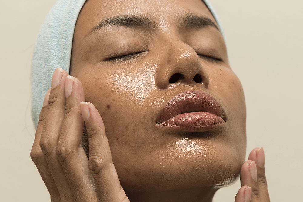 Myth busted: Yes, your oily skin does need a moisturizer