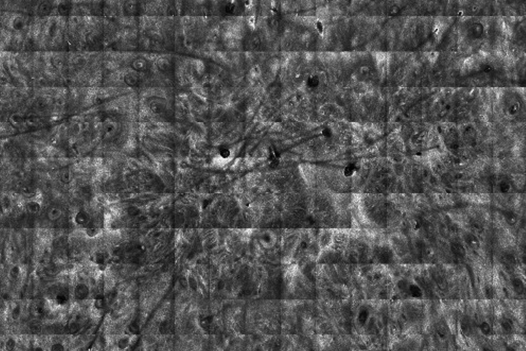 Reflectance Confocal Microscopy Image
