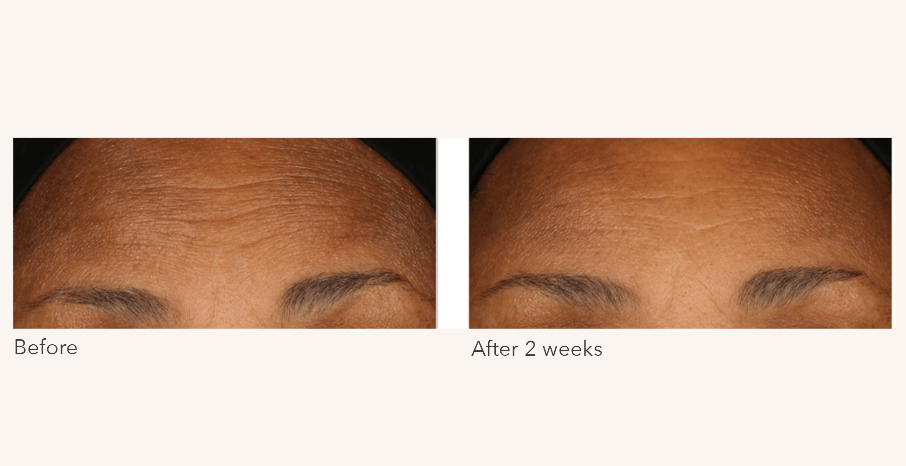 Before and after 2