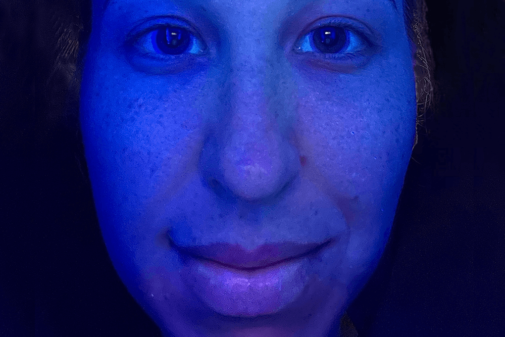 What is a Wood’s Lamp & What it Can Do For Your Skin